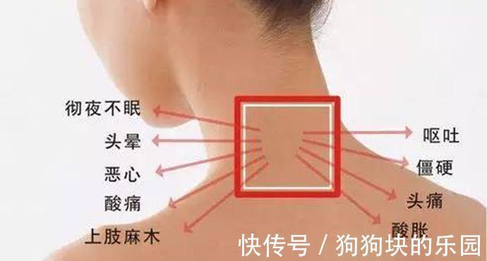 久治|颈椎病久治不愈，教你一招，“滚”出好颈椎