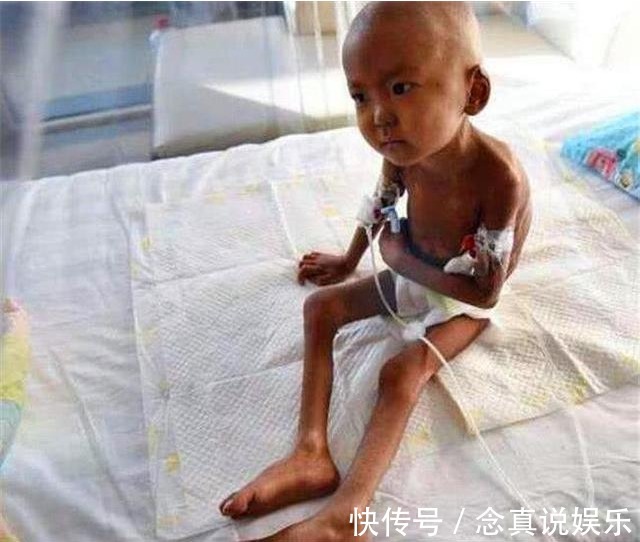 妈妈|5岁儿子枯瘦如柴,一个月没进食,他伸手想要吃东西却被妈妈阻止