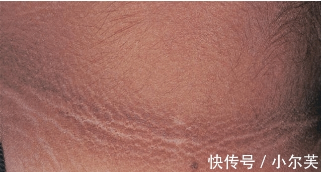 家长|9岁小女孩脖颈发黑洗不掉，经医院检查后，医生的话却让家长笑了