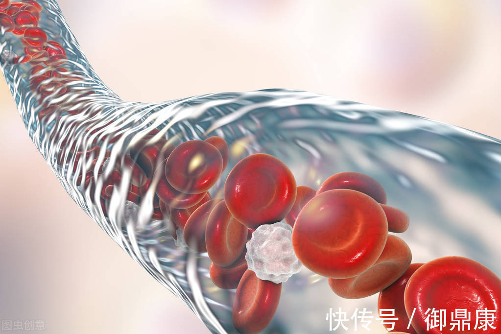 深度睡眠|睡眠时间越短,患高血压的风险越大吗?