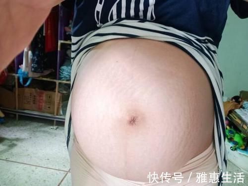发育|想了解胎儿发育情况,可以看看孕妈的肚脐,“凸出来”的要恭喜了