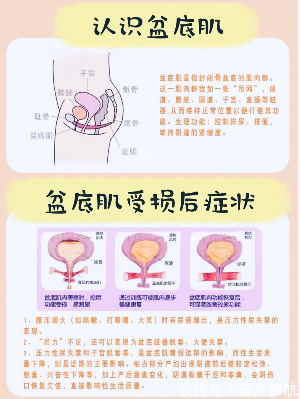 指南|产后修复避坑指南~产康修复别听婆婆的