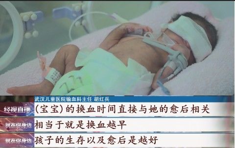 张祖国|全身大换血！新生儿突发这种疾病，医生提醒