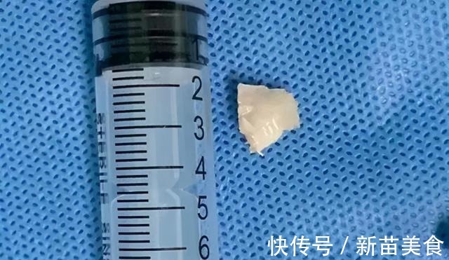 宁宁|请你不要这样逗我的孩子,会出人命的