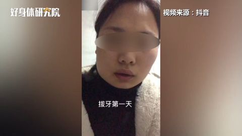 女子连拔3颗智齿肿成松鼠脸 专家称智齿若端正不用拔