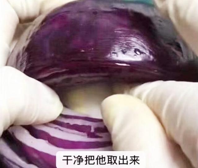 麻醉针|选剖腹产不疼这根10厘米的麻醉针仅仅是开始,疼到你怀疑人生