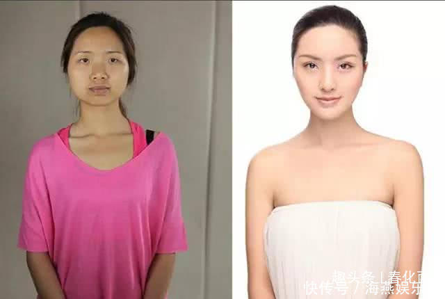 实拍：10张女孩整容前后的对比照，这真就是换了一张脸