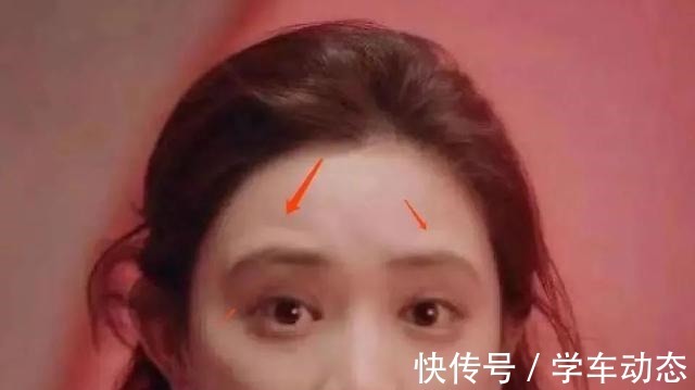 眉骨处 医美避坑理性变美,五大理由拒绝假体眉弓骨!