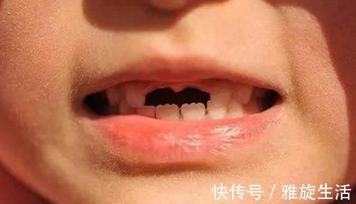 孩子|孩子“乳牙”脱落别着急扔,关键时刻能救命不懂为啥尽快了解下