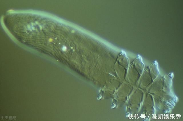 除螨|你可能已被“寄生虫”包围，有的在你脸上打洞，还有的住在毛囊里