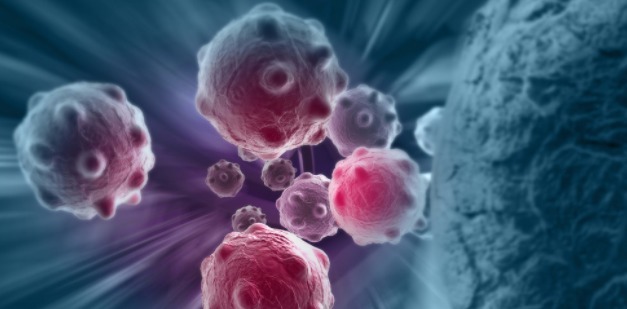 癌细胞|在你和癌症之间,只有四步之遥!大多数人到了第二步,还不知!