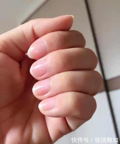 半月痕|手指甲上有月牙的人,与没有月牙的人,谁的身体更健康?