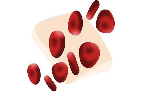 指标|体检时，如果血常规检查中3个指标异常，应该得到重视