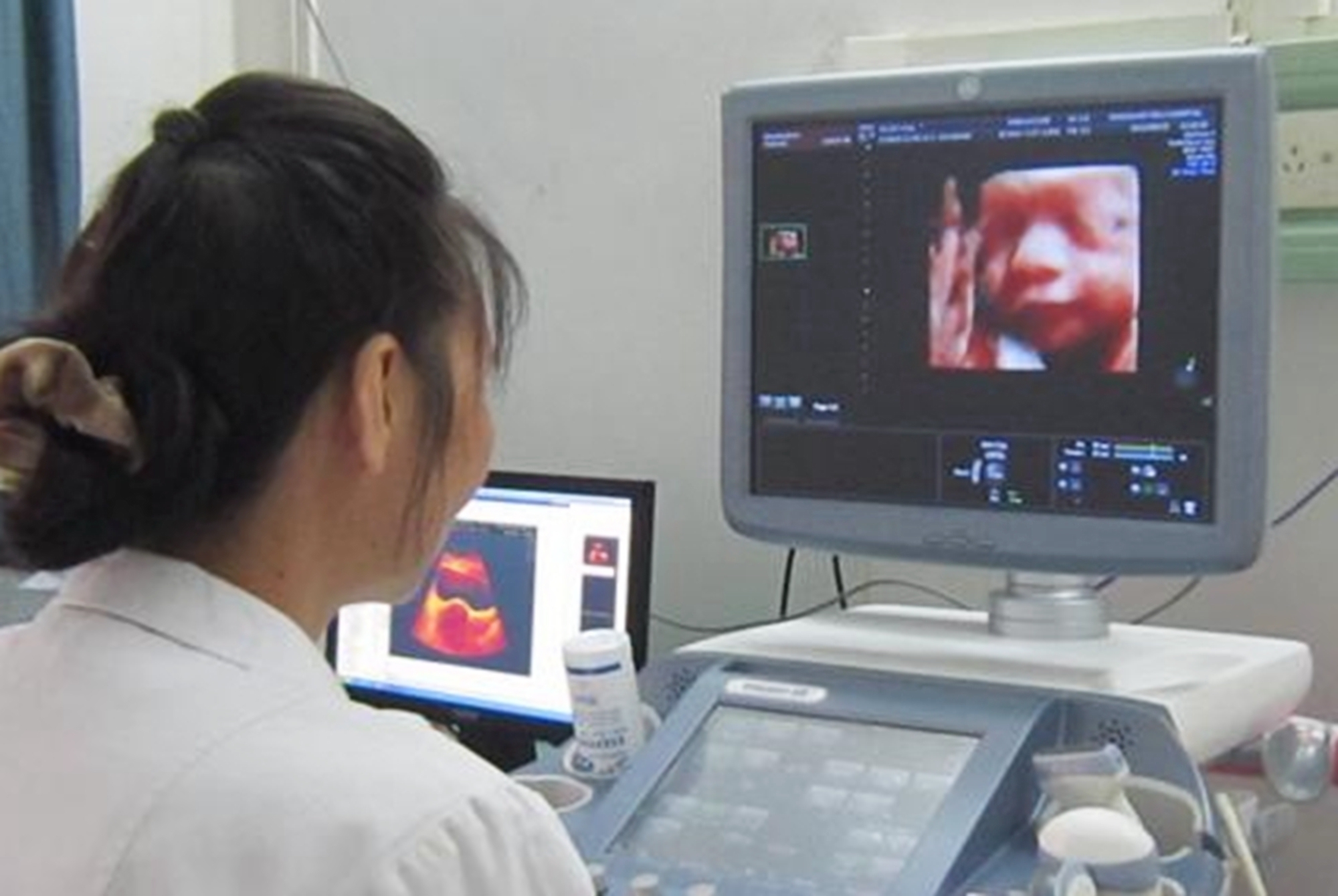 出血量|越来越多孕妈被“测出”孕酮值偏低,背后的真相和环境无关