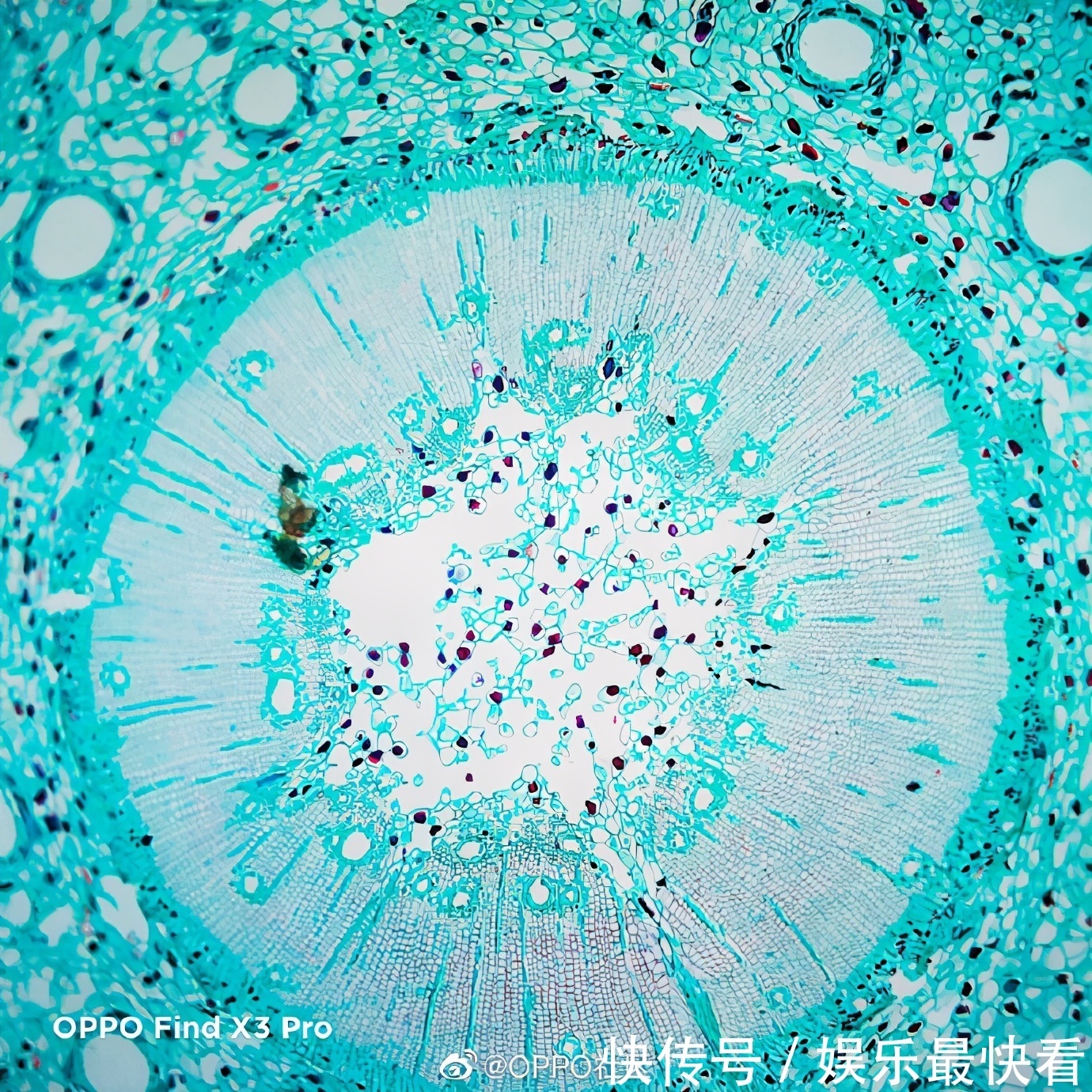 最近流行显微镜皮肤缺水测试？比美容院仪器还好使！直观又省钱