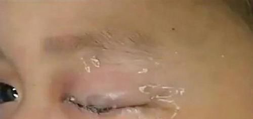 刘女士|5岁男孩将502滴入眼睛,随后妈妈的应急措施,医生都忍不住称赞