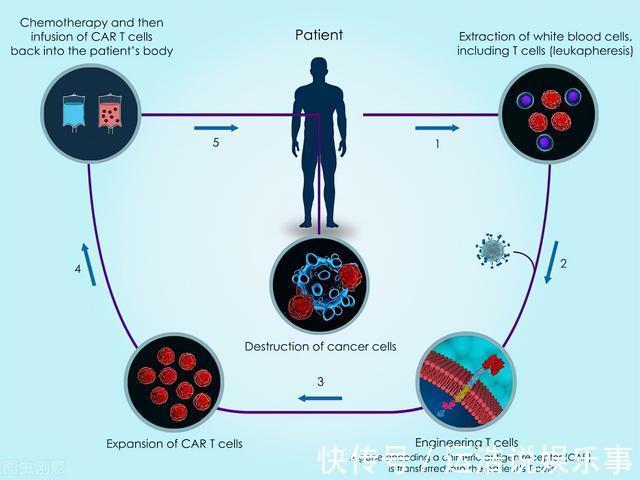治愈|120万一针的抗癌药,我国首例患者康复出院!能治愈所有癌症吗?