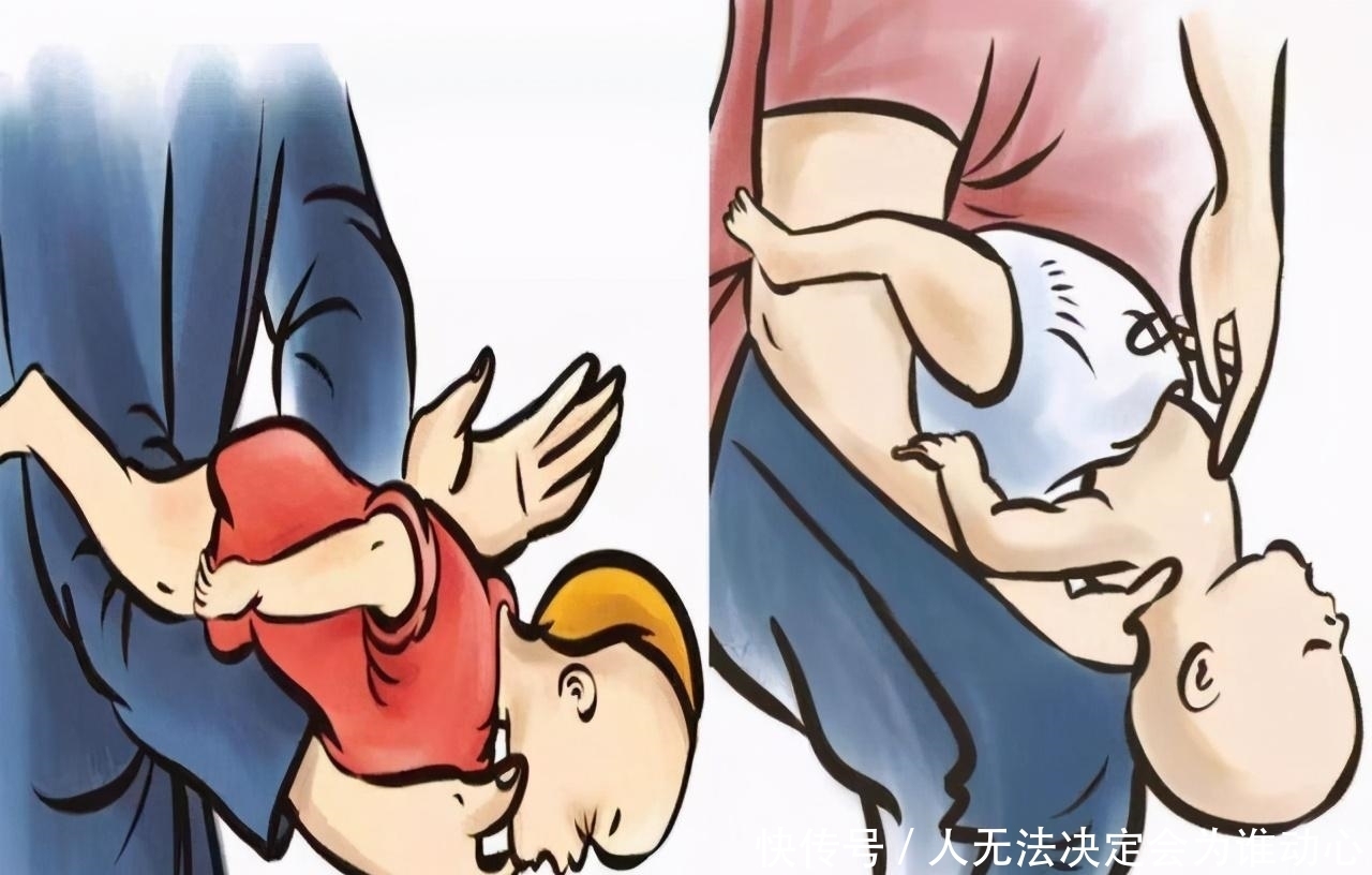 正确|警惕异物卡喉!不满一岁女娃吃小馒头险窒息,医生教你正确急救