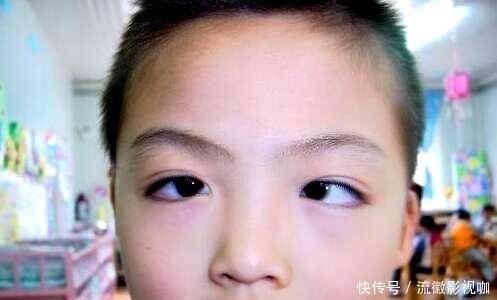 医生|5岁男孩一觉醒来,黑眼珠“消失”了,医生家长别太惯着孩子