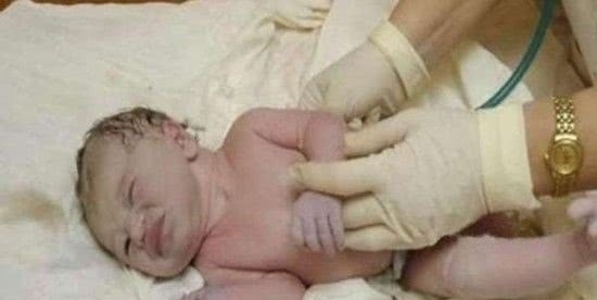 克鲁斯|婴儿刚生下被医生宣判死亡,爸妈在停尸房发现她还在呼吸