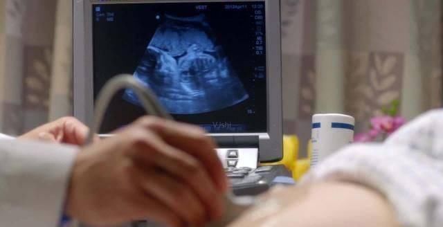 龙凤胎|孕妇生龙凤胎护士出门报喜,多说一句话被医院开除,原因令人唏嘘