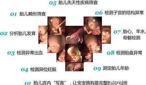 畸形|四维彩超能够预防胎儿畸形吗?四维彩超真正有6个作用,别搞错