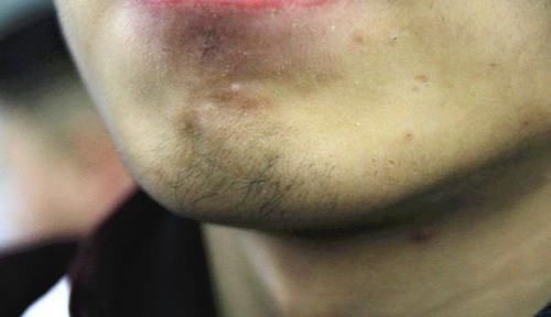 刮胡子|体内雄性激素充足的男人，大多有5个特征，占一个，值得恭贺