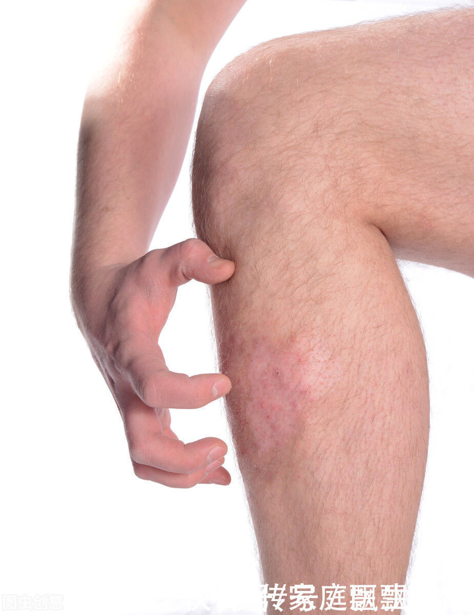 牵扯性|骨头疼痛是怎么回事?关于它的6大症状,早辨别早治疗