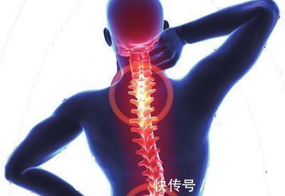 落枕|落枕可能是颈椎病变？很多颈椎病都是自己作出来的