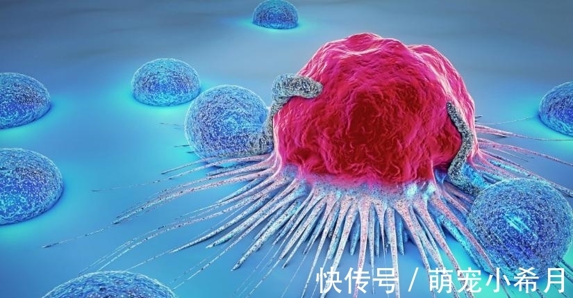 确诊|45岁男子确诊胃癌离世,生前不沾烟酒,却把这1种“素菜”当“饭”吃