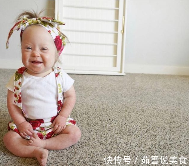 唐氏双胞胎|妈妈生下唐氏双胞胎姐妹,并不轻言放弃,唐宝都有一张相同的脸