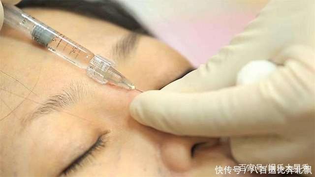 皮肤|经常打玻尿酸的女人,10年后容貌会有何变化?大美女说出实话!