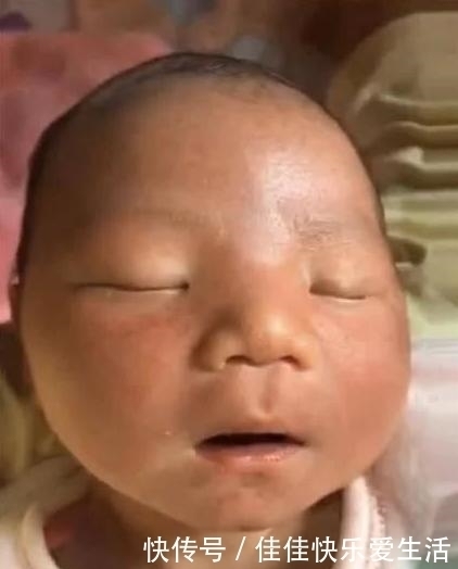 自然也就会|“黑脸宝宝”火了,出生后被家人嫌弃丑,2个月后逆袭成团宠