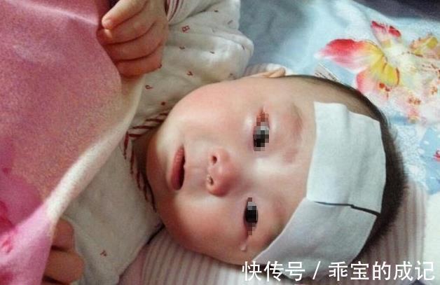 积食|8岁男童积食3年,拖成脾胃衰竭,医生:娃有5种表现,别再拖了