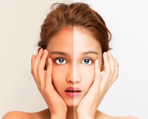 芳香世家王牧云：美白成分千千万，你PICK哪一个？