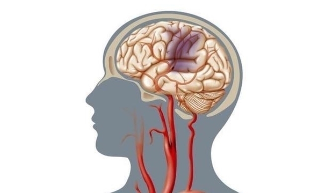 血管|改善脑供血不足“冠军”公布，洋葱靠边站，敞开肚子吃，血管会谢谢你！