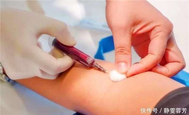 糖分|高血脂的人日常需要有哪些忌口？专家提醒：这3种食物需要注意