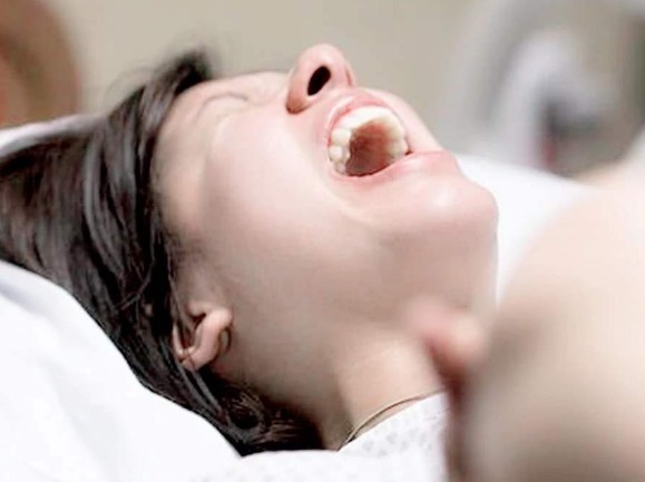 腰酸背痛|当年很火的“上环”,如今为何销声匿迹别再让爱人“上环”