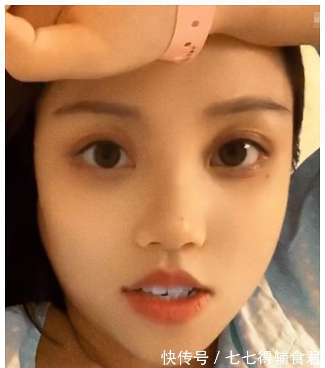 紫青|陕西一女子顺产后状态吓人,疼到满脸皮下出血,与生产前判若两人