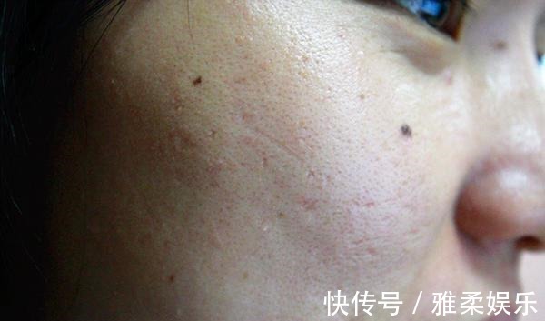 气血|脾衰,人就废一半,找到脾的“恩人”,坚持吃,养好脾脏