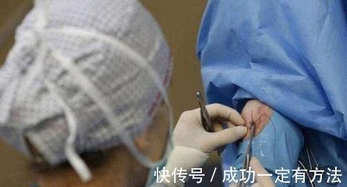 医生|孕妇须知:顺产侧切后,缝针会不会很疼?答案跟你想的不一样