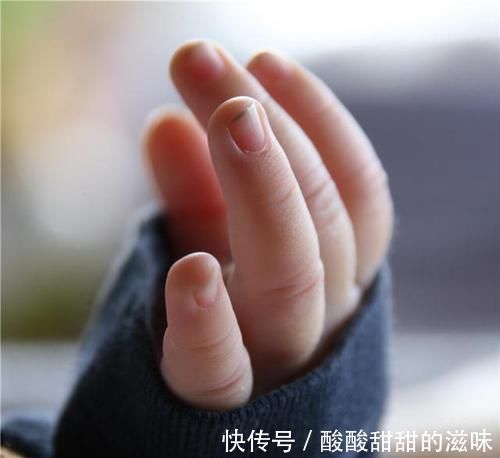 圆圆|5岁女孩喜欢“咬指甲”,宝妈无奈求医,医生太晚了,拔了吧