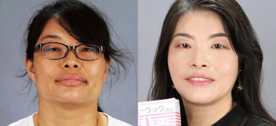 为什么刚洗完脸皮肤白白净净，5分钟后就暗沉？很多人都做错了