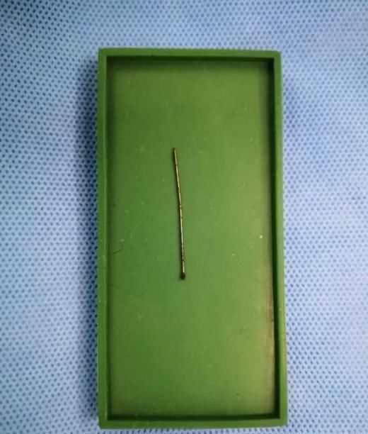 家属|3岁女孩天天咳嗽,医院检查后,医生怒斥家属:“太粗心了”