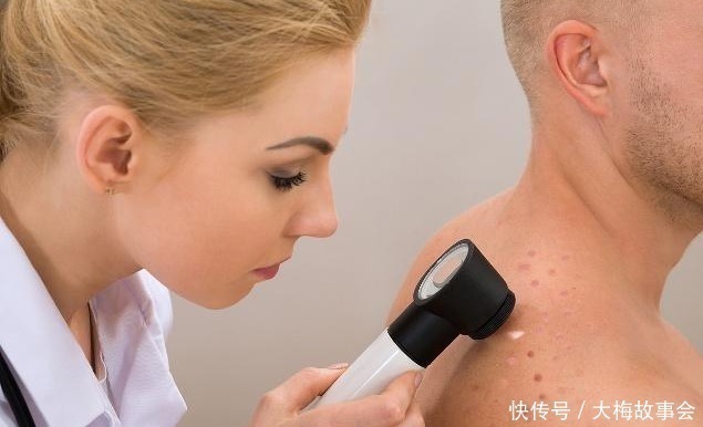 基底细胞癌|只因搓破身上一颗小痣，25岁男子患上癌，这些痣都需要谨慎