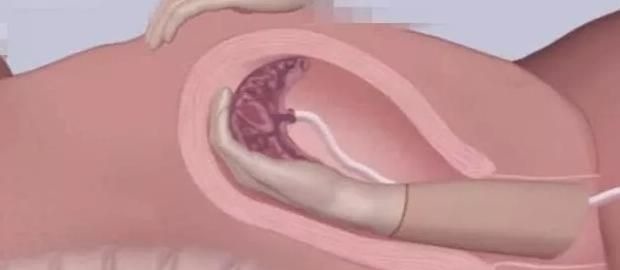 侧切|顺产最痛的四个瞬间,过来人坦言第三个强忍,第四个彻底崩溃了