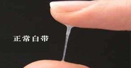 诊治|子宫健康,上厕所时没有4个表现,常做3事,吃2物,让身体更健康