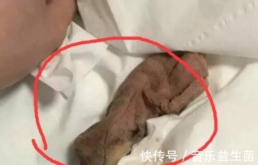 麻醉针|女子身体疼痛难忍,去医院拍片检查,手术取出后,丈夫大怒