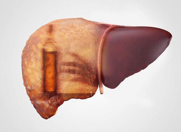 植物蛋白|如何养肝护肝,六大方法让肝更健康!