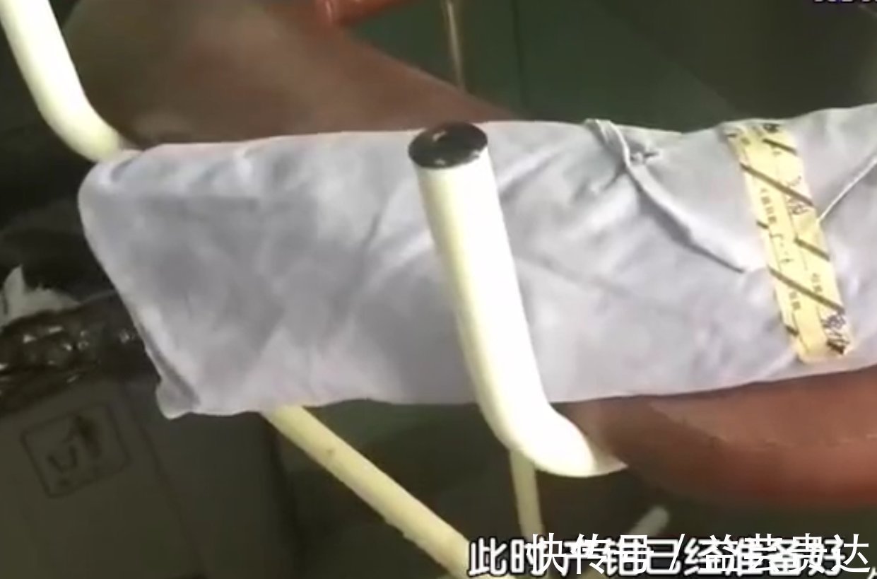 宫缩|助产士生娃:痛得咬老公,同事准备产钳助产,差点顺产转剖宫产